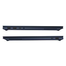 Acheter HP OmniBook X Next Gen AI 14-ka0011nf