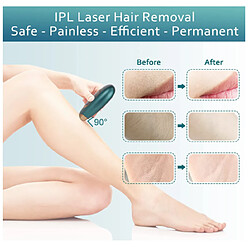 Acheter Chrono Appareil d'épilation IPL, Appareils IPL à domicile Épilation au laser Épilateur au laser portable indolore pour peau douce, rose