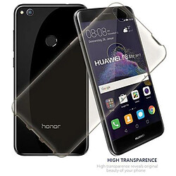 Avis Cadorabo Coque Huawei P8 LITE 2017 / P9 LITE 2017 Etui en Noir