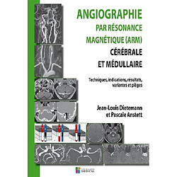 Angiographie par résonance magnétique (ARM) cérébrale et médullaire : techniques, indications, résultats, variantes et pièges - Occasion