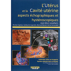 L'utérus et la cavité utérine : aspects échographiques et hystéroscopiques - Occasion