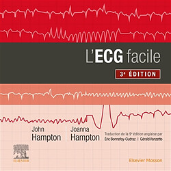 L'ECG facile