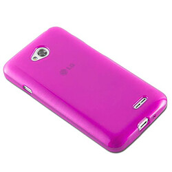 Avis Cadorabo Coque LG L70 (1. SIM) Etui en Rose