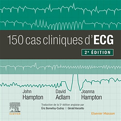 150 cas cliniques d'ECG