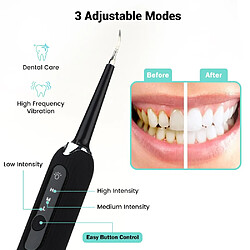 Universal Électrique, sonore, dentaire, brûlures dentaires, détergent calculé, nettoyage des taches dentaires, outils Tati, têtes de brosse remplaçables.