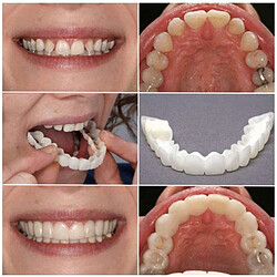 Acheter Sourire Snap Faux Placages De Dents Couvre-dents Cosmétique Accolades Supérieures Des Dents