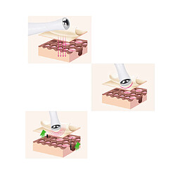 Dispositif de beauté de beauté oculaire de beauté de beauté de beauté électrique M22