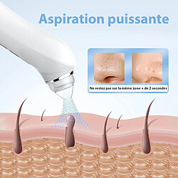 Acheter Chrono Aspirateur points noirs avec caméra HD