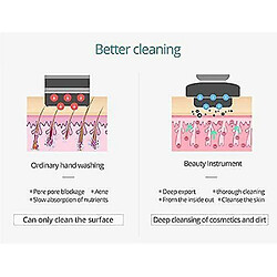 Avis Chrono Appareil de soin du visage RF