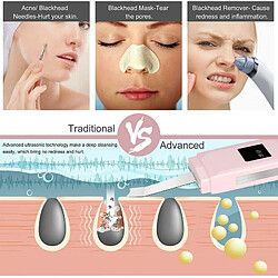 Chrono Épurateur ultrasonique pour le visage pas cher