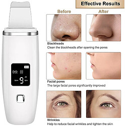 Chrono épurateur ultrasonique visage - Blanc pas cher