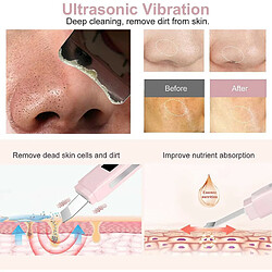 Acheter Chrono Épurateur ultrasonique pour le visage