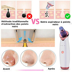Avis Chrono aspirateur points noirs visage