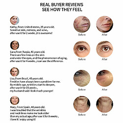 Justgreenbox appareil soin du visage RF pas cher