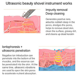 Wewoo spatule visage ultrasonique pas cher
