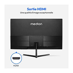 Moniteur grand écran - MEDION - AKOYA P52218 MD 20150 - 54,6 cm (22'') Full HD - HDR10 - HDMI - Sans cadre pas cher