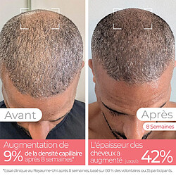 Stylideas Root Renew Red Light