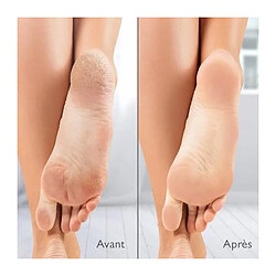 Avis Silk N Silk'n VacuPedi râpe anti-callosités