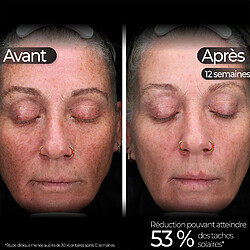 Acheter Stylideas masque LED visage 5-en-1 Wavelength Pro