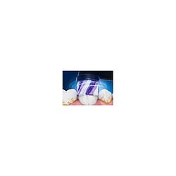 Avis Brossette dentaire Oral B iO Radiant White Noire X3