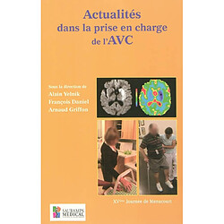 Actualités dans la prise en charge de l'AVC