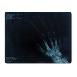 Totalcadeau Mouse Pad X-Ray Hand