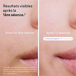Avis Braun PL7253 - Rose