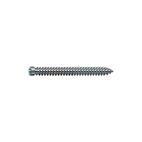 SPAX-RA Vis d'ancrage châssis Ø7,5x100 mm boîte de 100