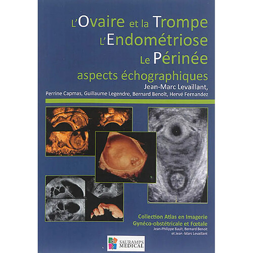 L'ovaire et la trompe, l'endométriose, le périnée : aspects échographiques · Occasion