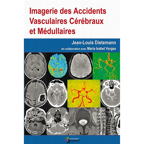 Imagerie des accidents vasculaires cérébraux et médullaires · Occasion